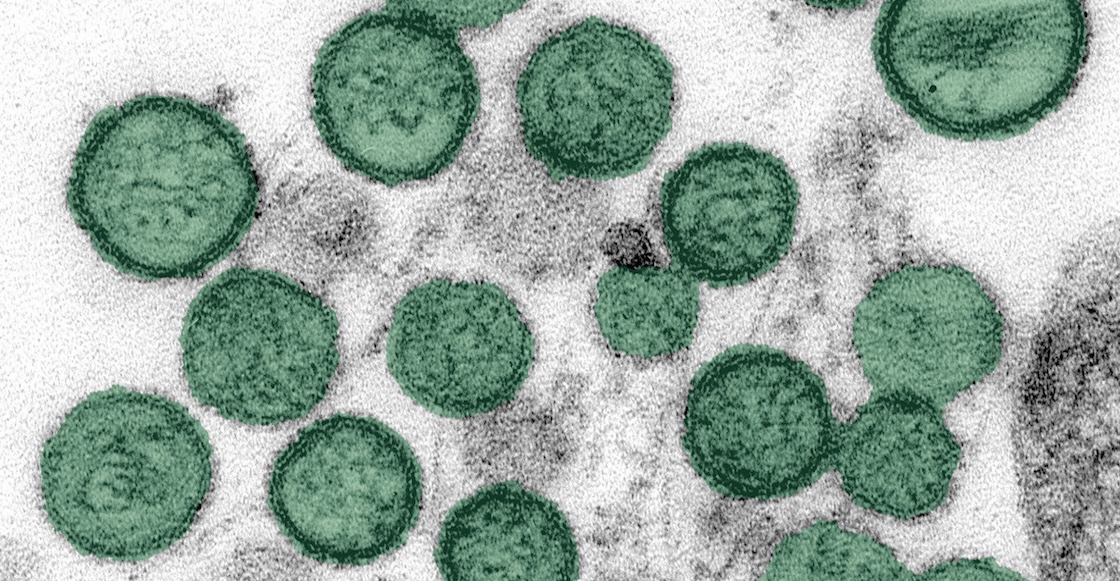 🚨🦠 Alerta sanitaria: la Organización Mundial de la Salud confirmó un caso de hantavirus en Suiza, lo que ha encendido las alertas sobre esta peligrosa enfermedad.